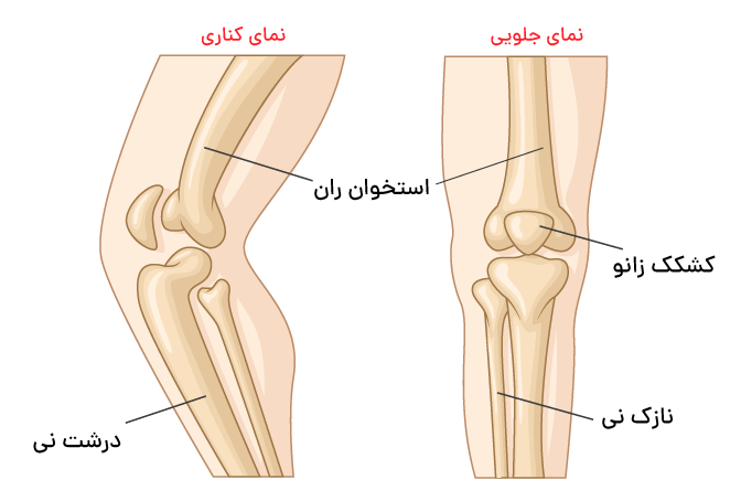 کاربرد انواع زانو بند طبی