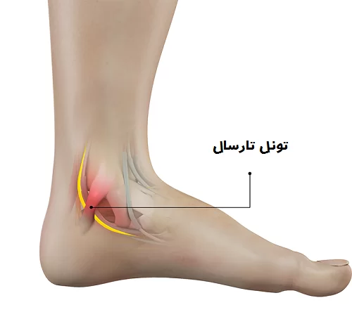 تونل تارسال