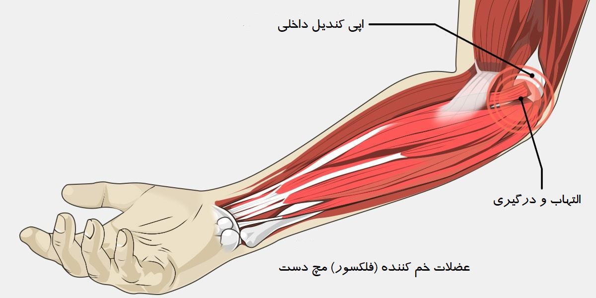 علائم آرنج گلف بازان
