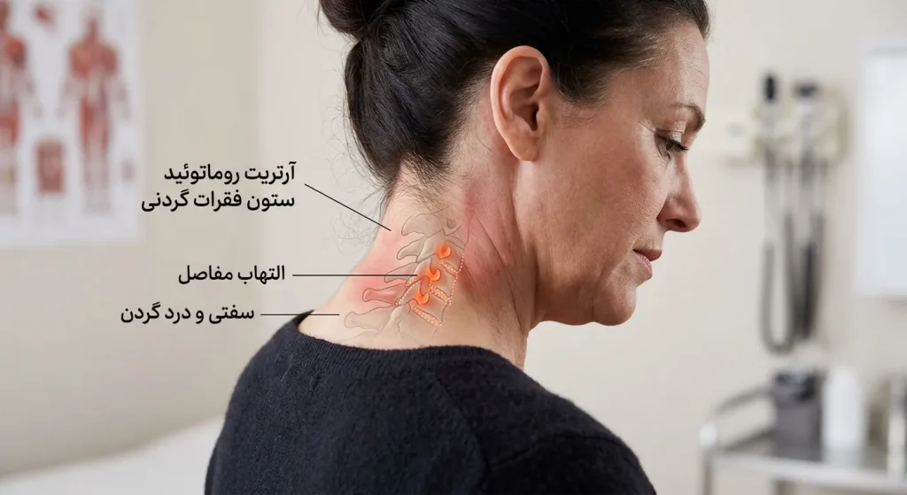 روماتیسم گردن