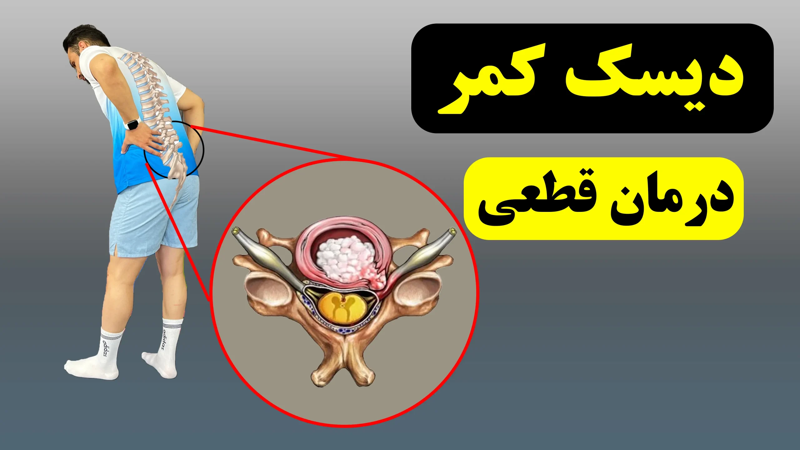 راهکار های درمان‌  دیسک کمر 
فیزیوتراپی فانتوم زنجان