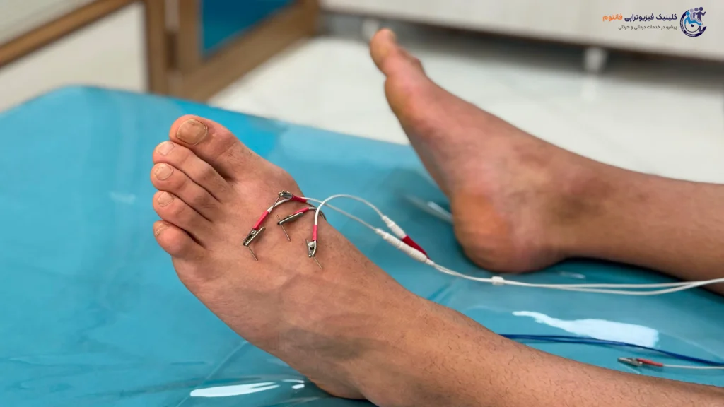 طب سوزنی یا آکوپانکچرـ تصویر از فیزیوتراپی فانتوم زنجان