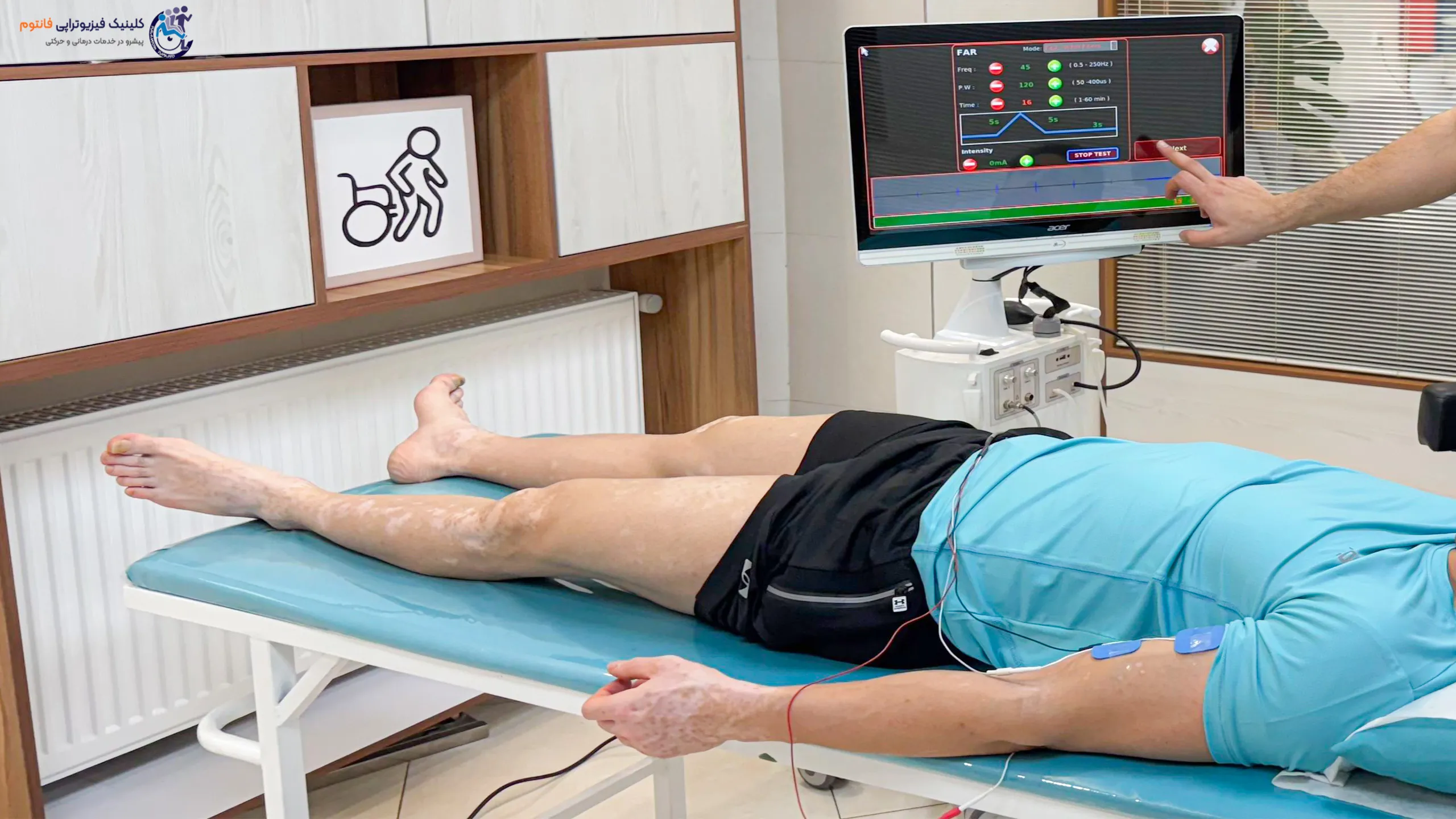 بیوفیدبک بازو- تصویر از فیزیوتراپی فانتوم زنجان
