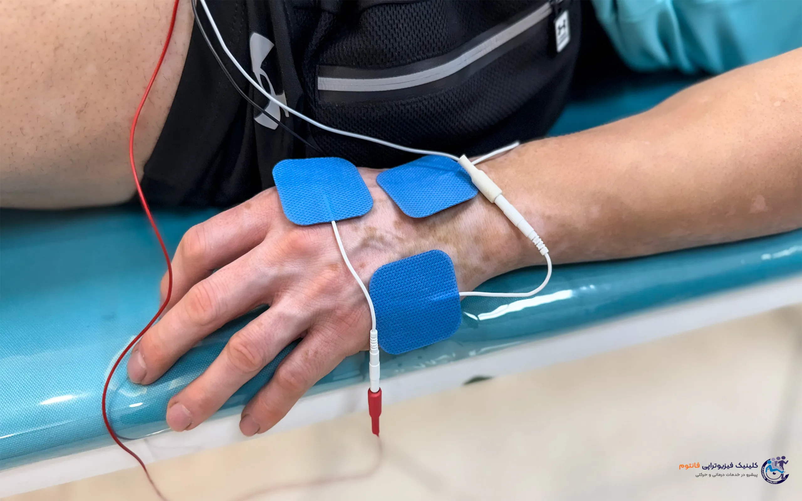 بیوفیدبک روی دست- تصویر از فیزیوتراپی فانتوم زنجان