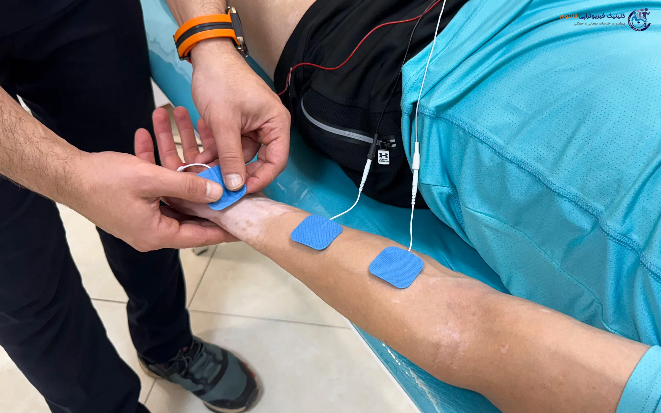 بیوفیدبک روی ساعد دست- تصویر از فیزیوتراپی فانتوم زنجان