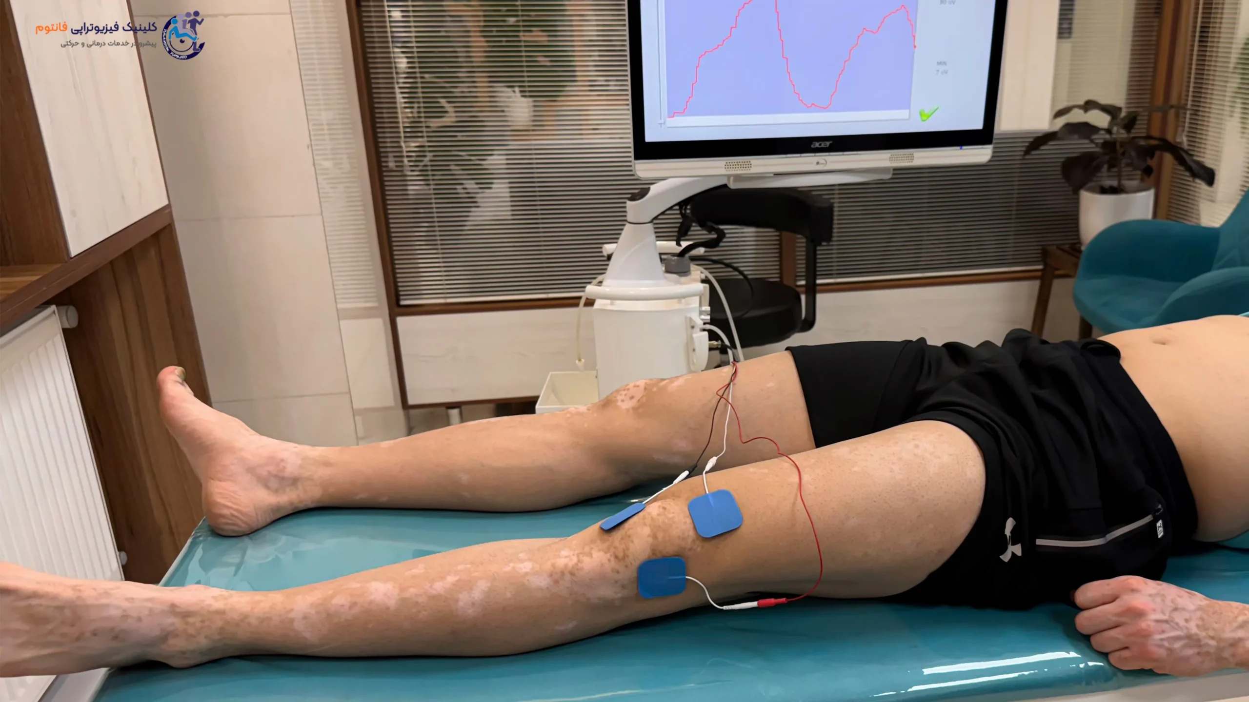 بیوفیدبک زانو- تصویر از فیزیوتراپی فانتوم زنجان