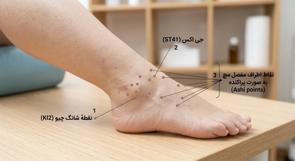 نقاط طب سوزنی مچ پا