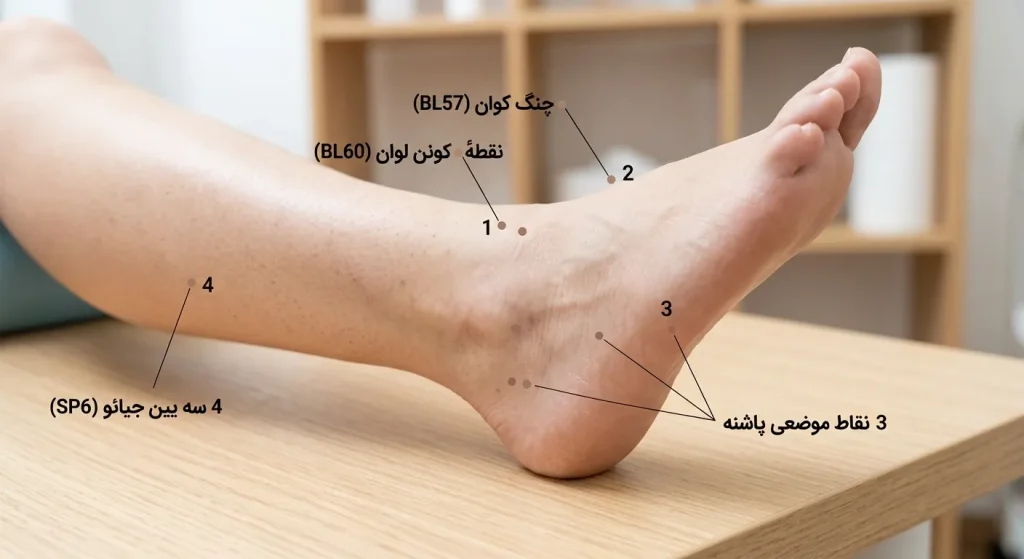 نقاط طب سوزنی پاشنه پا